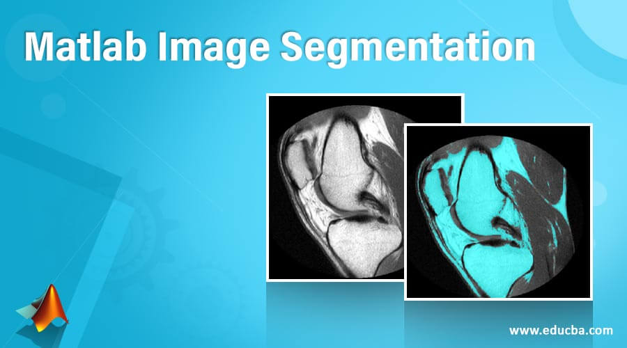 Matlab Image Segmentation