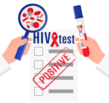 HIV Test