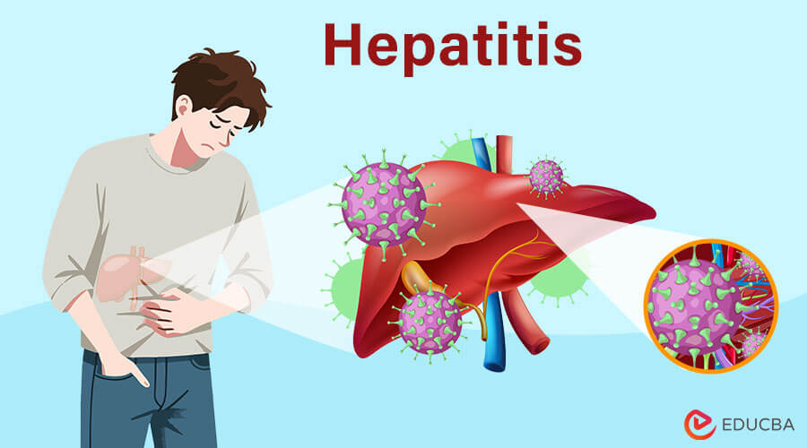 Hepatitis