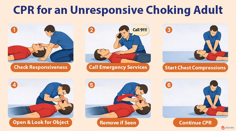 CPR for an Unresponsive Choking Adult